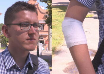 Działacz PiS pobity w centrum Radomia. Poseł Suski: „To polityczne porachunki”